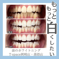 画像432