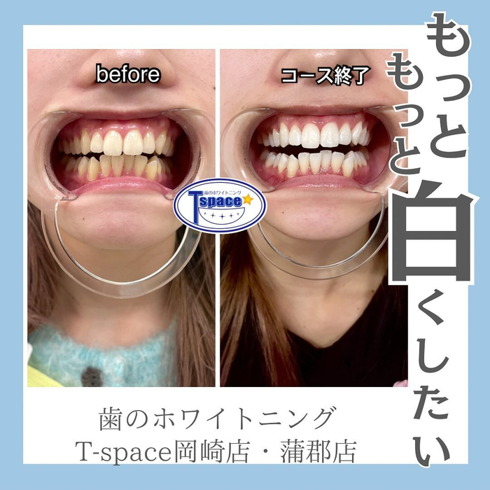 画像433