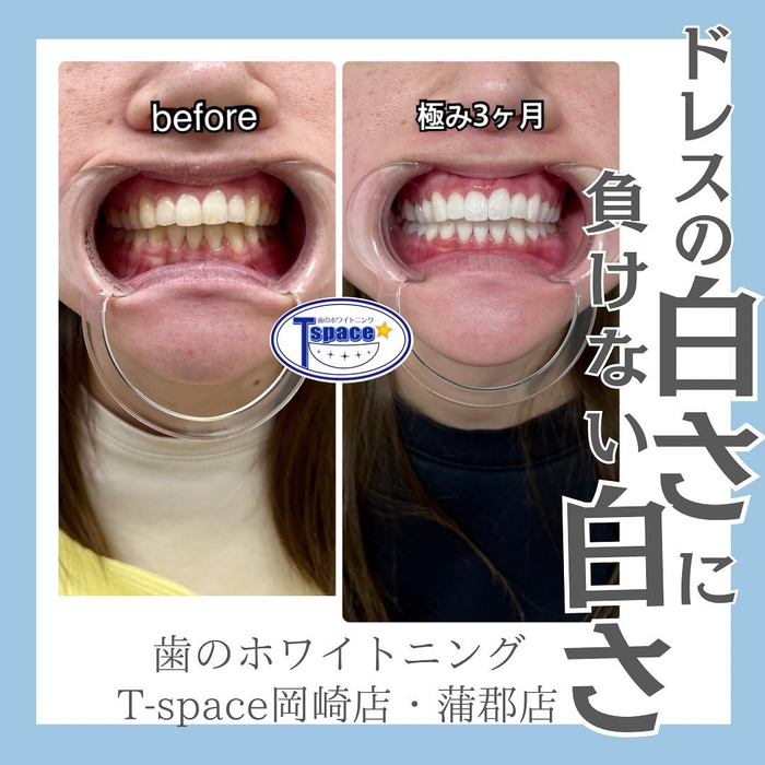画像439