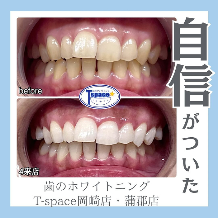 画像444
