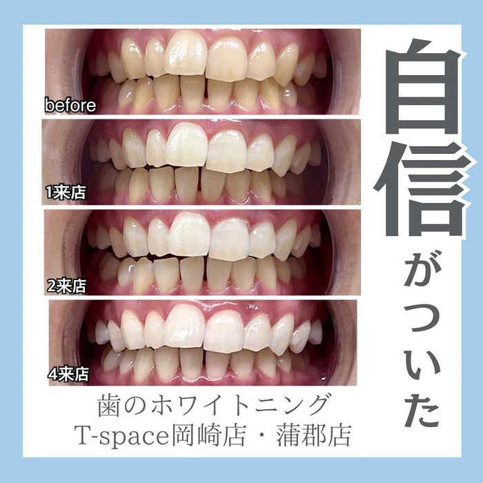 画像445