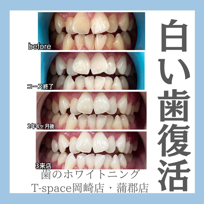 画像452