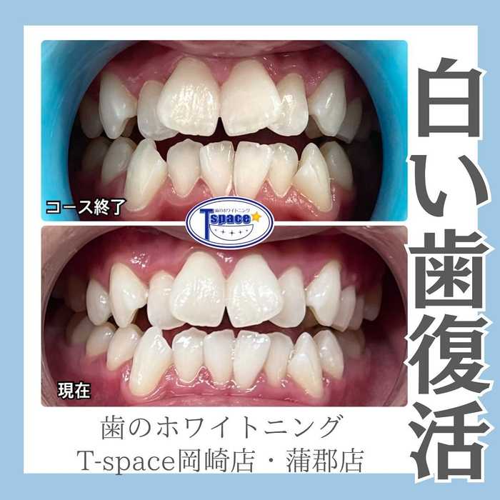 画像453