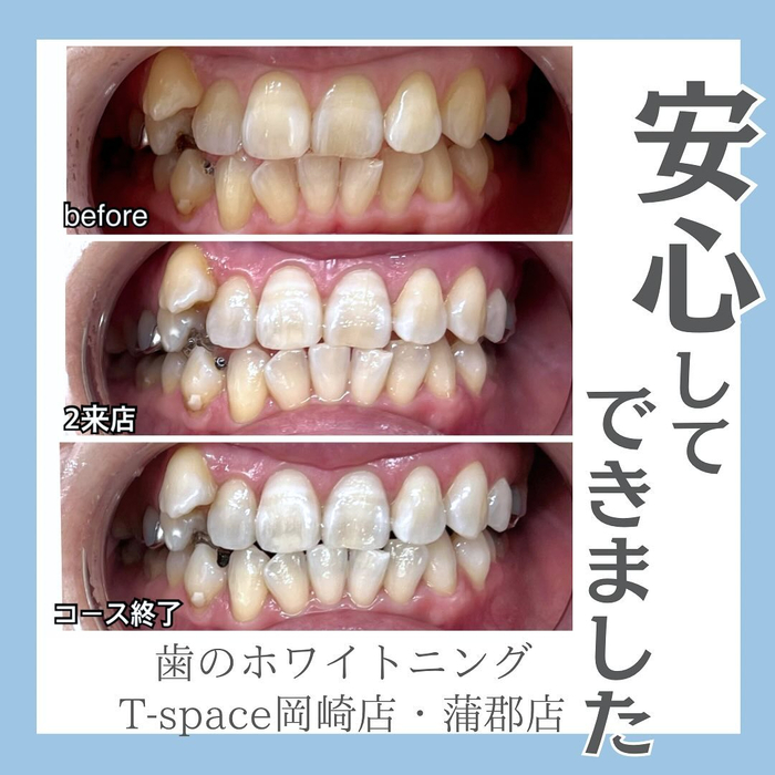 画像457