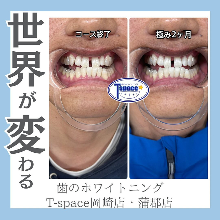 画像481