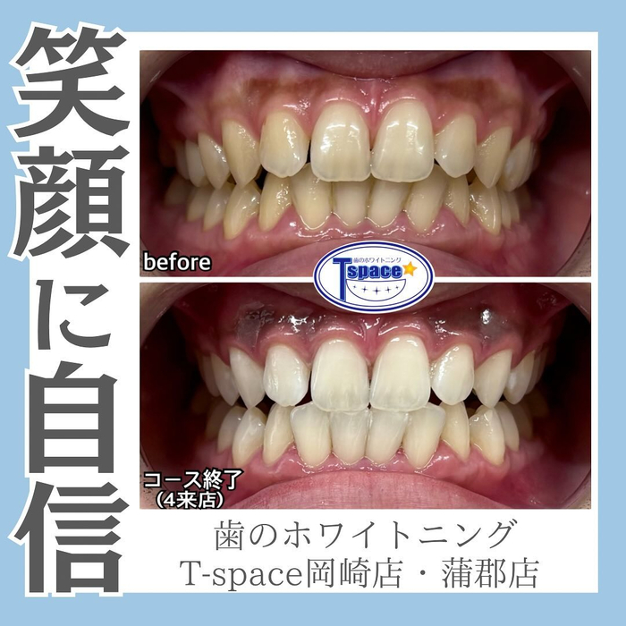 画像486