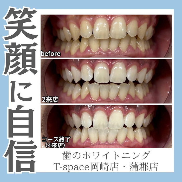 画像487