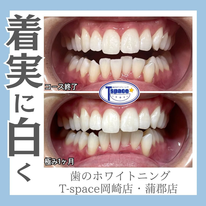 画像495