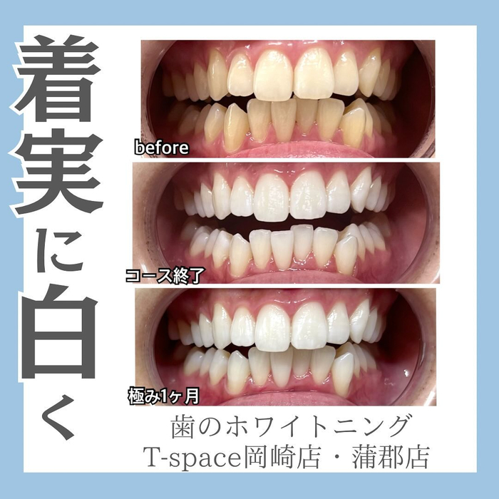 画像496