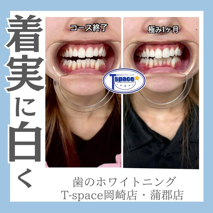 画像497