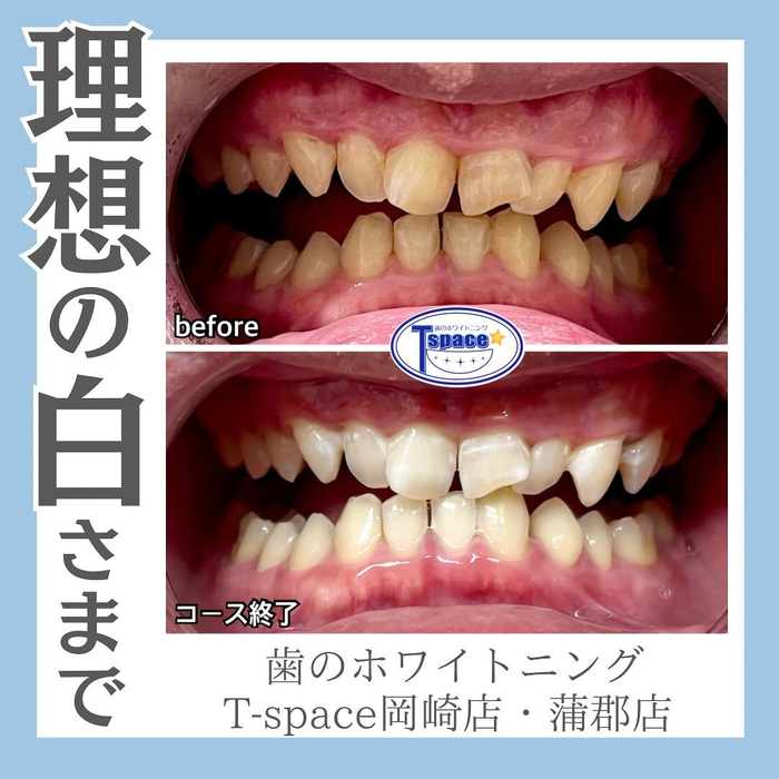 画像502