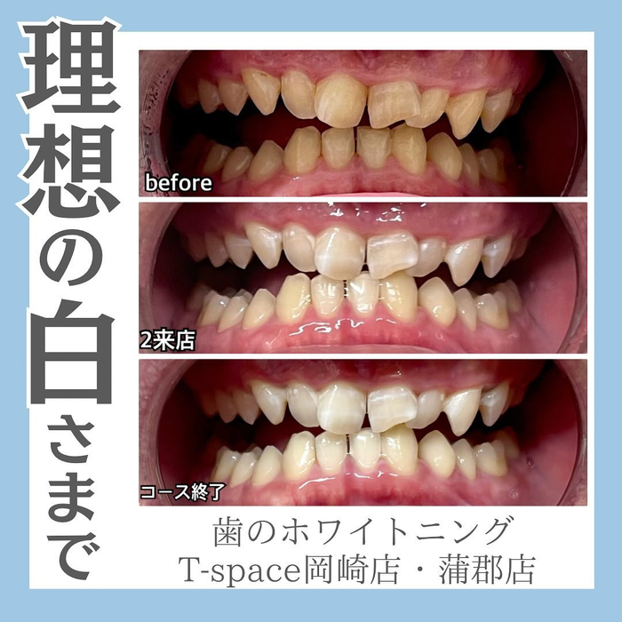 画像503