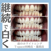 画像510