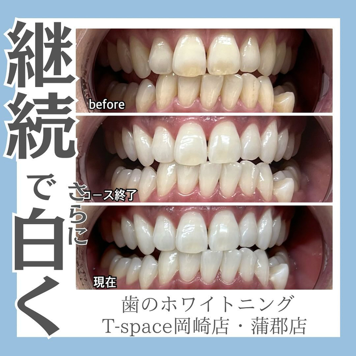 画像510