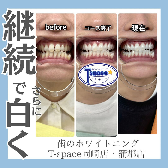 画像511