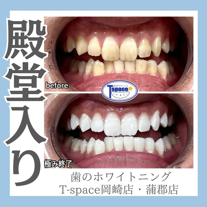 画像516