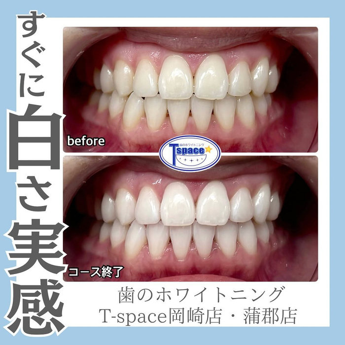 画像523