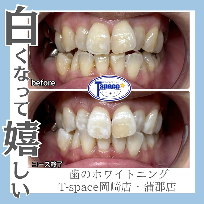 画像530