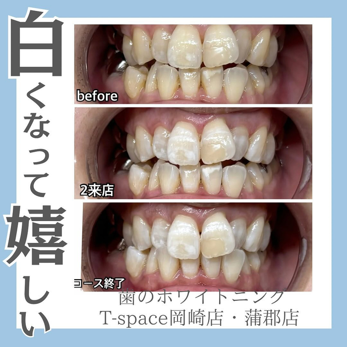 画像531