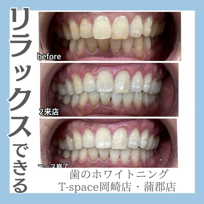 画像537