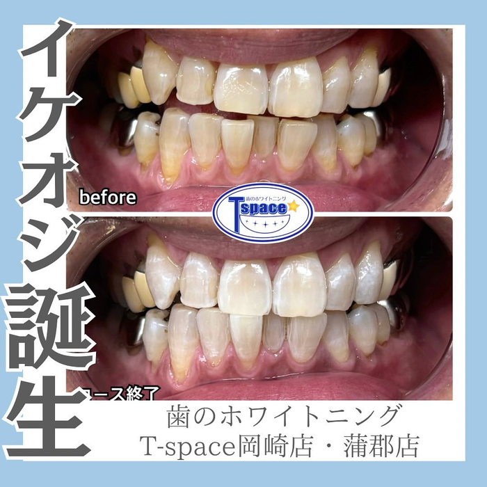 画像546