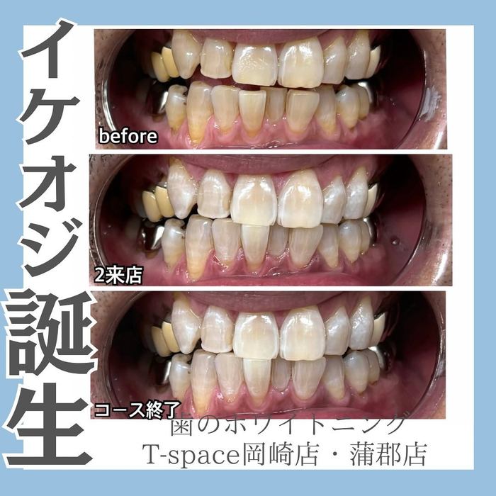 画像547