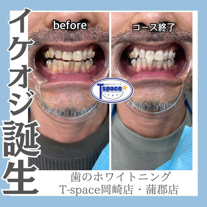 画像548