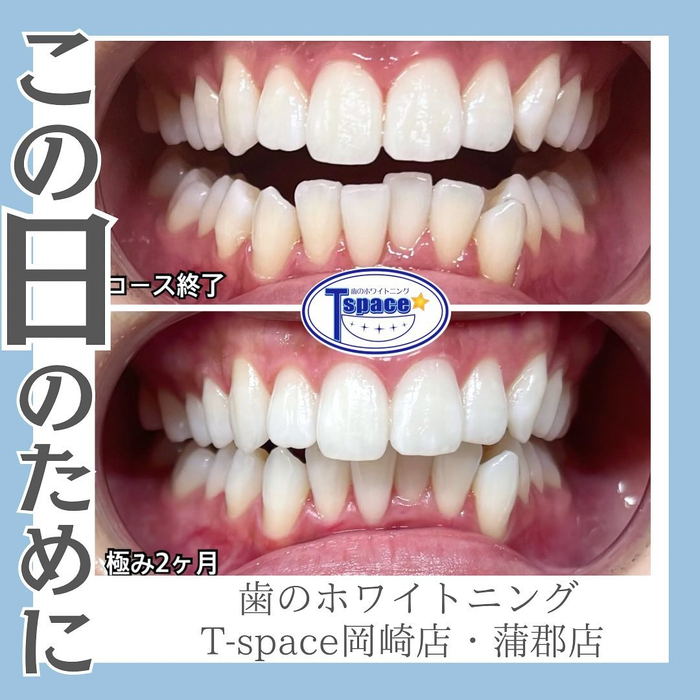 画像556