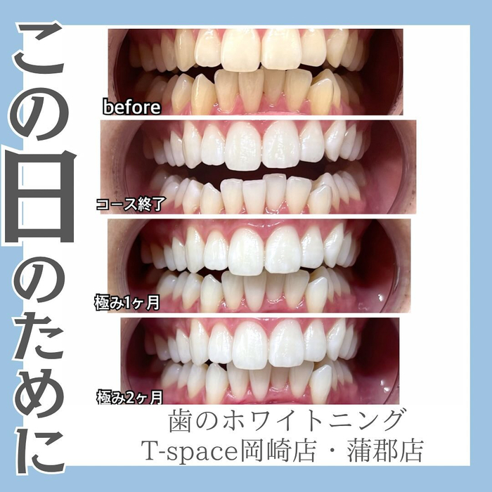 画像557
