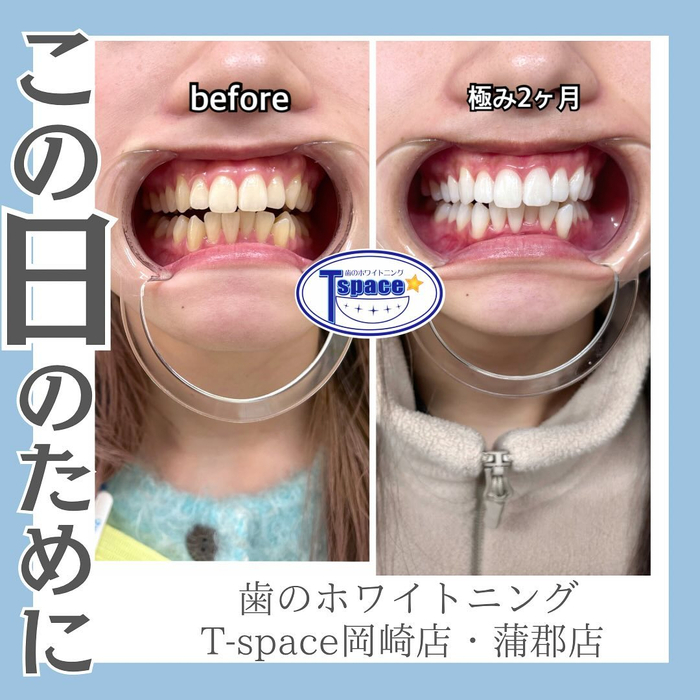 画像558