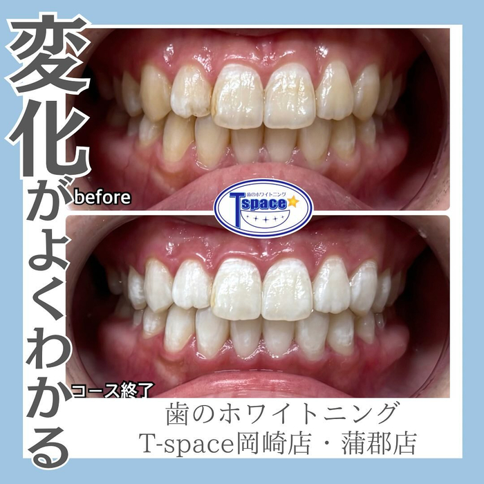 画像564