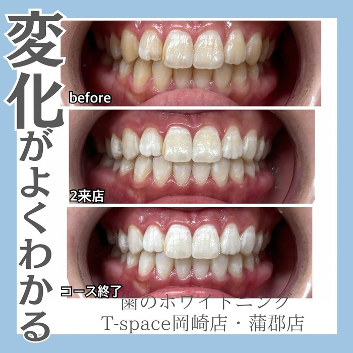 画像565