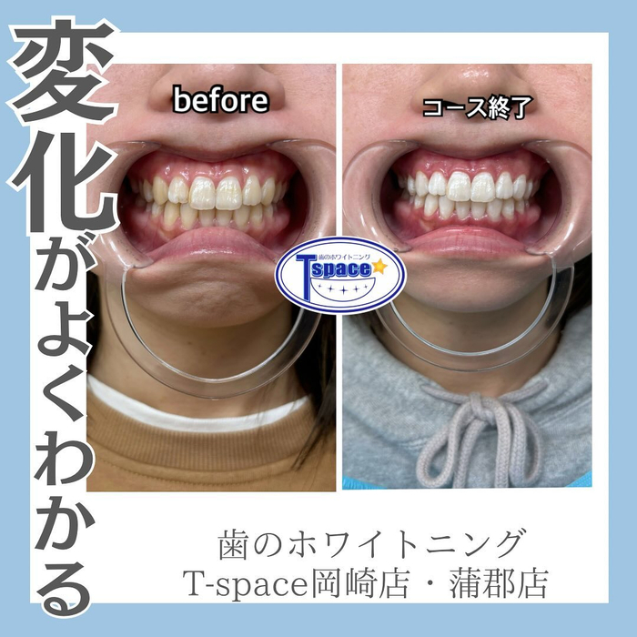 画像566
