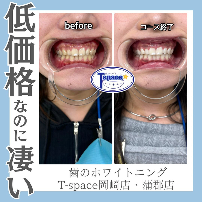 画像582