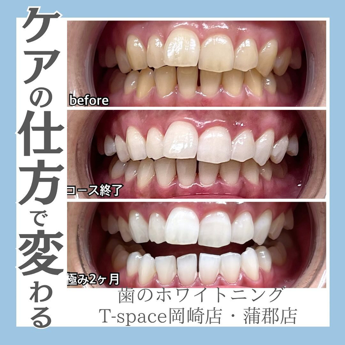 画像590