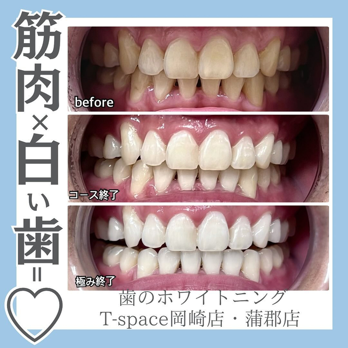 画像608