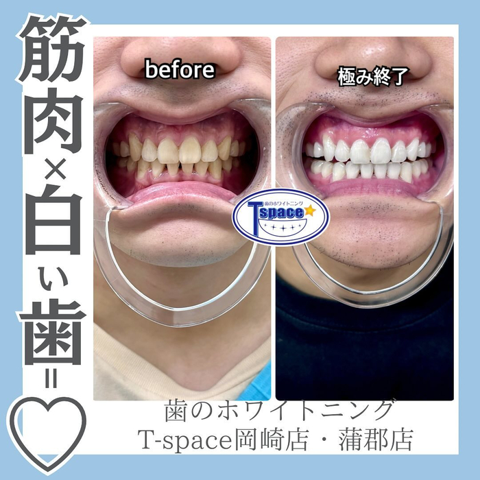 画像609