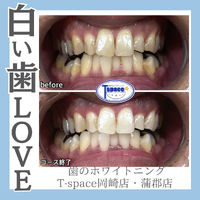 画像615