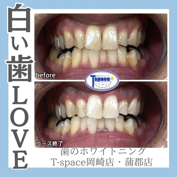 画像615