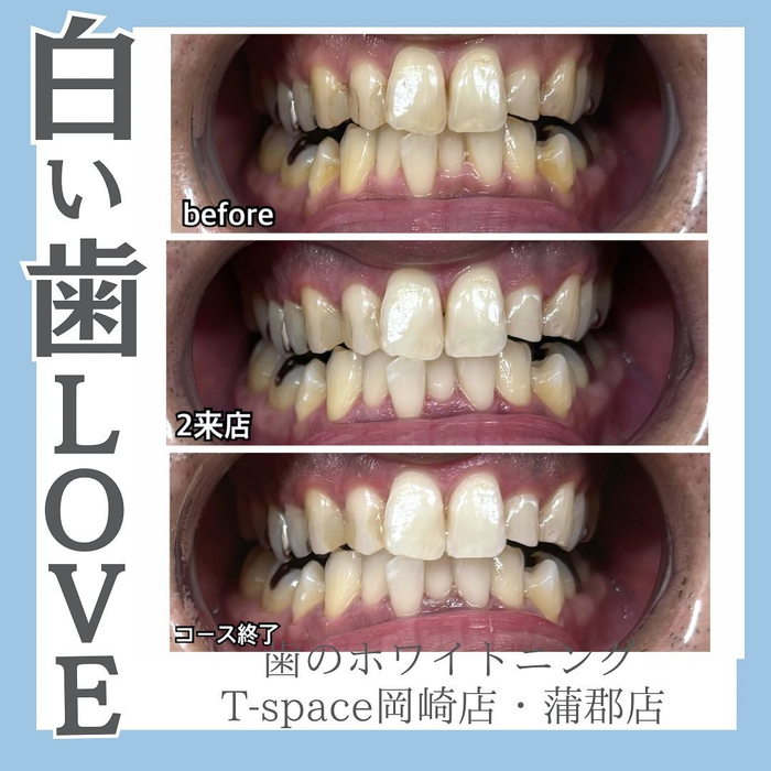 画像616