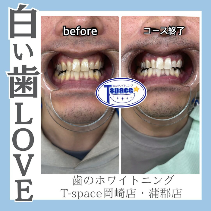 画像617