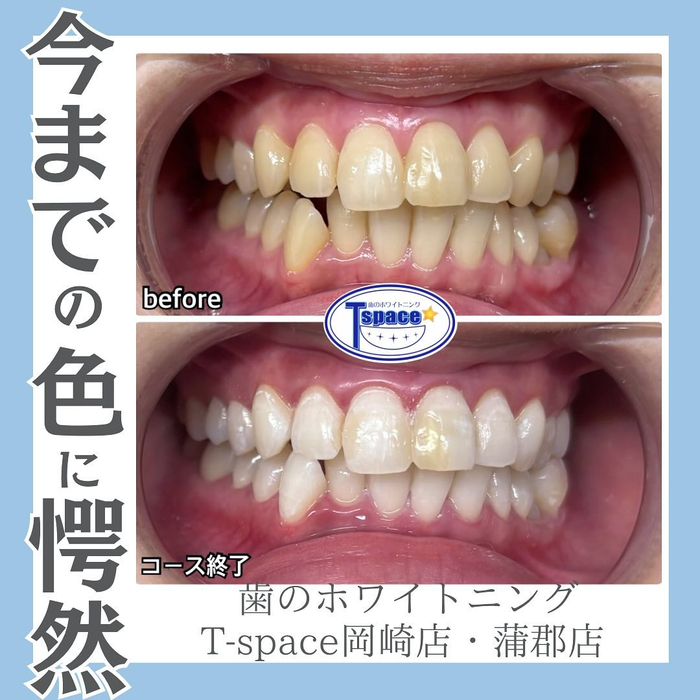 画像625