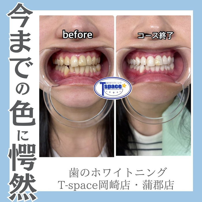 画像627