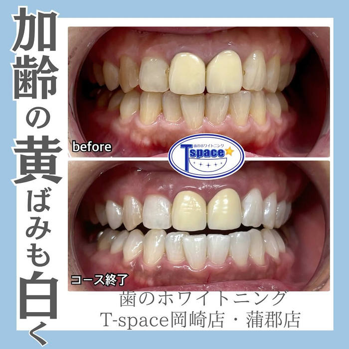 画像634