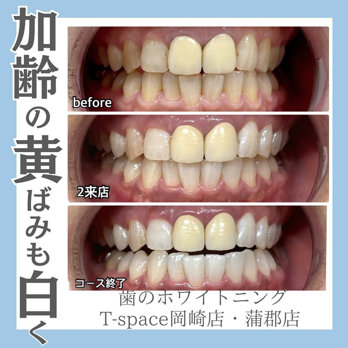 画像635