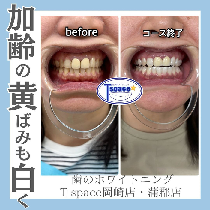 画像636
