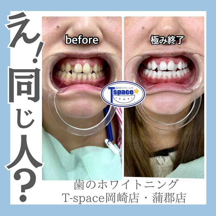 画像645