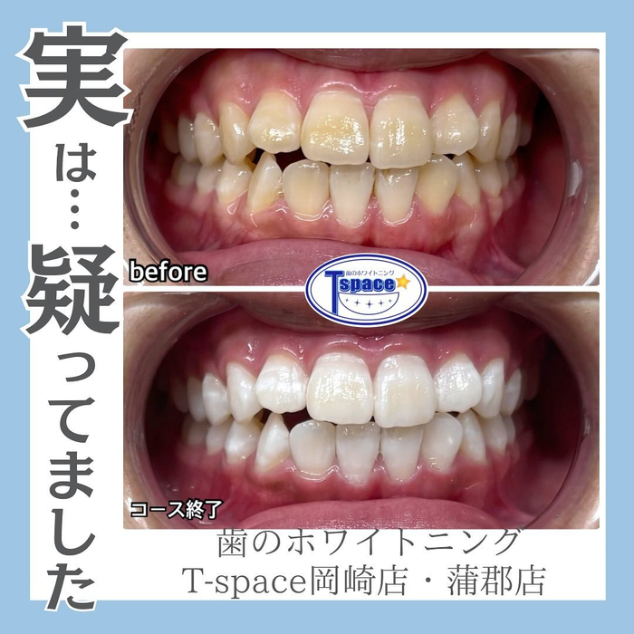 画像651