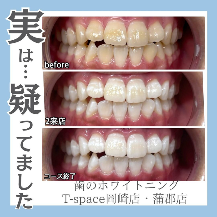 画像652