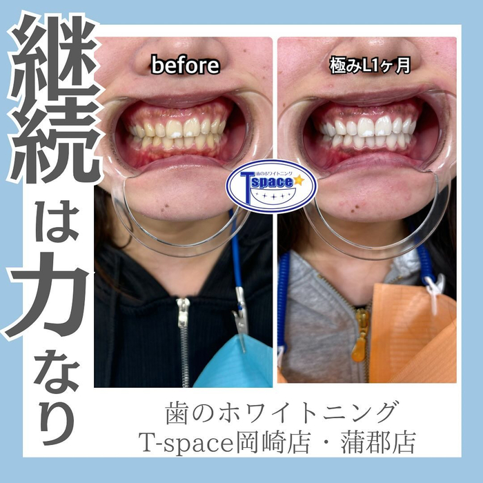 画像661